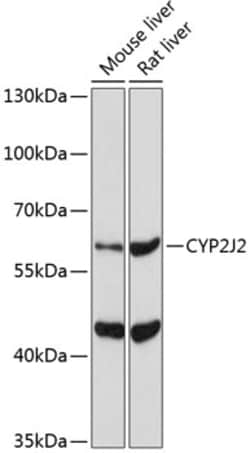Invitrogen CYP2J2 Polyclonal Antibody 100 &mu;L | Buy Online | Invitrogen&trade; | Fisher Scientific