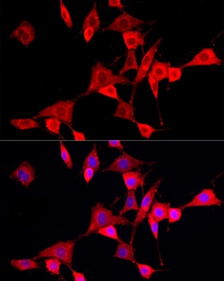 Invitrogen CYP4V2 Polyclonal Antibody 100 &mu;L; Unconjugated:Antibodies,