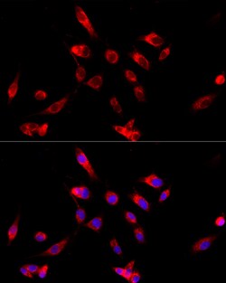 Invitrogen CYP4V2 Polyclonal Antibody 100 &mu;L; Unconjugated:Antibodies,