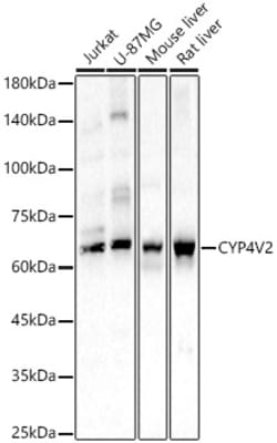 Invitrogen CYP4V2 Polyclonal Antibody 100 &mu;L; Unconjugated:Antibodies,