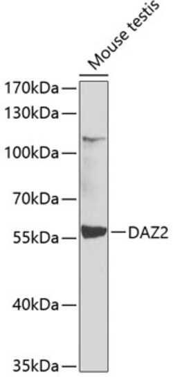 DAZ2 Polyclonal Antibody:Antibodies, Polyclonal