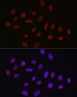 Invitrogen DDX39A Polyclonal Antibody 100 &mu;L; Unconjugated:Antibodies,