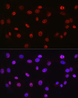 Invitrogen DDX39A Polyclonal Antibody 100 &mu;L; Unconjugated:Antibodies,