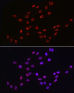 Invitrogen DDX39A Polyclonal Antibody 100 &mu;L; Unconjugated:Antibodies,