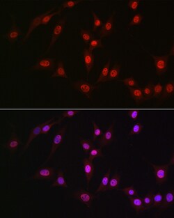 Invitrogen DDX39A Polyclonal Antibody 100 &mu;L; Unconjugated:Antibodies,