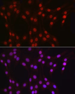 Invitrogen DDX39A Polyclonal Antibody 100 &mu;L; Unconjugated:Antibodies,