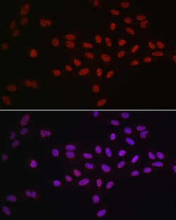 Invitrogen DDX39A Polyclonal Antibody 100 &mu;L; Unconjugated:Antibodies,