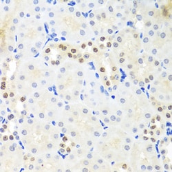 Invitrogen DDX39A Polyclonal Antibody 100 &mu;L; Unconjugated:Antibodies,