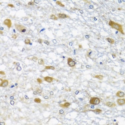 Invitrogen DDX39A Polyclonal Antibody 100 &mu;L; Unconjugated:Antibodies,