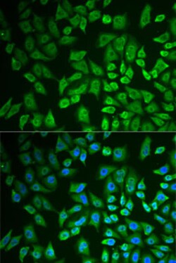Invitrogen DDX41 Polyclonal Antibody 100 &mu;L; Unconjugated:Antibodies,