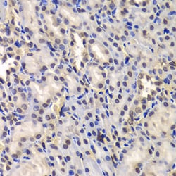 Invitrogen DDX41 Polyclonal Antibody 100 &mu;L; Unconjugated:Antibodies,