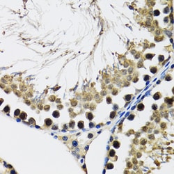 Invitrogen DDX41 Polyclonal Antibody 100 &mu;L; Unconjugated:Antibodies,