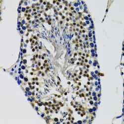 Invitrogen DDX41 Polyclonal Antibody 100 &mu;L; Unconjugated:Antibodies,