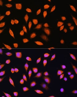 Invitrogen PNPO Polyclonal Antibody 100 &mu;L; Unconjugated:Antibodies,