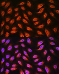 Invitrogen PNPO Polyclonal Antibody 100 &mu;L; Unconjugated:Antibodies,