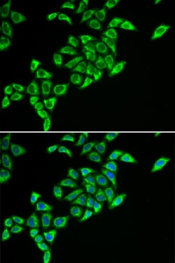 Invitrogen DLAT Polyclonal Antibody 100 &mu;L; Unconjugated:Antibodies,