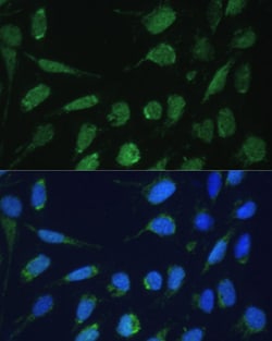 Invitrogen DLST Polyclonal Antibody 100 μL; Unconjugated:Antibodies,
