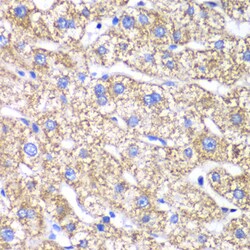 Invitrogen DLST Polyclonal Antibody 100 μL; Unconjugated:Antibodies,