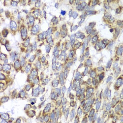 Invitrogen DLST Polyclonal Antibody 100 μL; Unconjugated:Antibodies,
