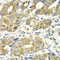 Invitrogen DLST Polyclonal Antibody 100 μL; Unconjugated:Antibodies,