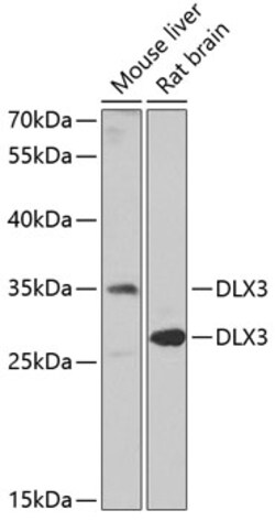 Invitrogen DLX3 Polyclonal Antibody 100 &mu;L | Buy Online | Invitrogen&trade; | Fisher Scientific
