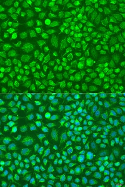 DNAL1 Polyclonal Antibody:Antibodies, Polyclonal