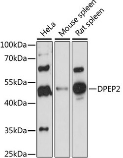 DPEP2 Polyclonal Antibody 100 &mu;L | Buy Online | Invitrogen | Fisher Scientific