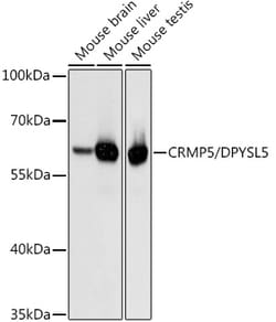 Invitrogen CRMP5 Polyclonal Antibody 100 &mu;L; Unconjugated:Antibodies,