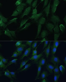 Invitrogen DRG2 Polyclonal Antibody 100 &mu;L | Buy Online | Invitrogen&trade; | Fisher Scientific