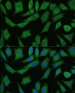 Invitrogen DRG2 Polyclonal Antibody 100 &mu;L | Buy Online | Invitrogen&trade; | Fisher Scientific