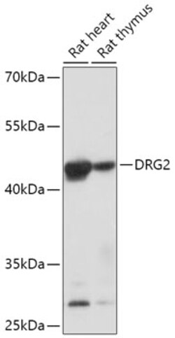 Invitrogen DRG2 Polyclonal Antibody 100 &mu;L | Buy Online | Invitrogen&trade; | Fisher Scientific