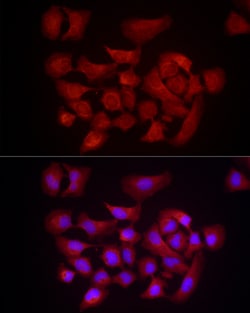 Invitrogen DUSP8 Polyclonal Antibody 100 &mu;L; Unconjugated:Antibodies,