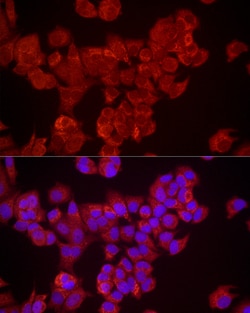 Invitrogen DUSP8 Polyclonal Antibody 100 &mu;L; Unconjugated:Antibodies,