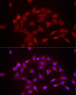 Invitrogen DUSP8 Polyclonal Antibody 100 &mu;L; Unconjugated:Antibodies,