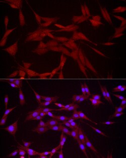 Invitrogen DUSP8 Polyclonal Antibody 100 &mu;L; Unconjugated:Antibodies,