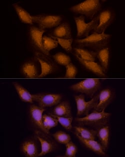 Invitrogen ECSIT Polyclonal Antibody 100 &mu;L | Buy Online | Invitrogen&trade; | Fisher Scientific
