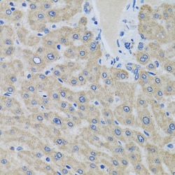 Invitrogen eIF2 gamma Polyclonal Antibody 100 &mu;L; Unconjugated:Antibodies,