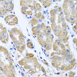 Invitrogen eIF2 gamma Polyclonal Antibody 100 &mu;L; Unconjugated:Antibodies,