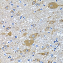 Invitrogen eIF2 gamma Polyclonal Antibody 100 &mu;L; Unconjugated:Antibodies,