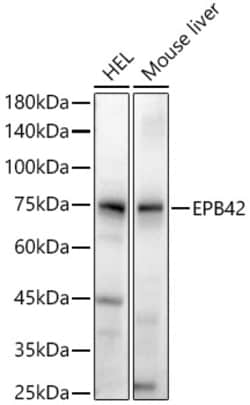 Invitrogen EPB42 Polyclonal Antibody 100 &mu;L; Unconjugated:Antibodies,