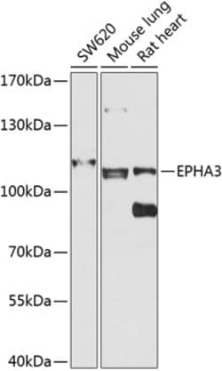 Invitrogen EphA3 Polyclonal Antibody 100 &mu;L; Unconjugated:Antibodies,