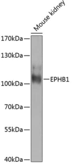 Invitrogen EphB1 Polyclonal Antibody 100 &mu;L; Unconjugated:Antibodies,
