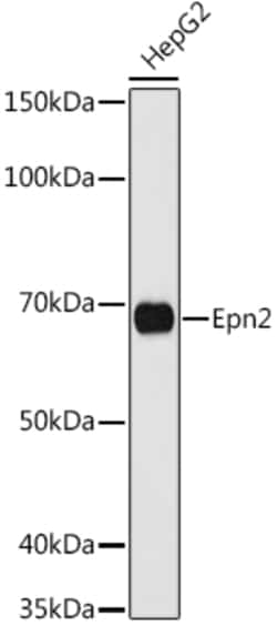 EPN2 Polyclonal Antibody:Antibodies, Polyclonal