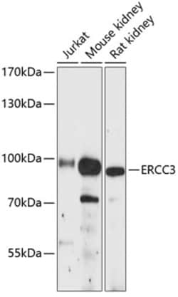 Invitrogen ERCC3 Polyclonal Antibody 100 &mu;L; Unconjugated:Antibodies,