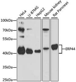Invitrogen ERP44 Polyclonal Antibody 100 &mu;L; Unconjugated:Antibodies,