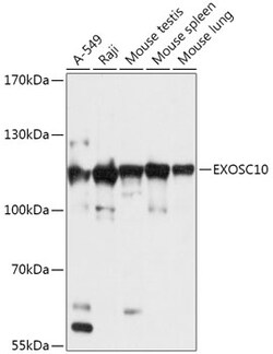 Invitrogen EXOSC10 Polyclonal Antibody 100 &mu;L; Unconjugated:Antibodies,