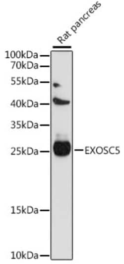 Invitrogen EXOSC5 Polyclonal Antibody 100 &mu;L; Unconjugated:Antibodies,