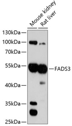 Invitrogen FADS3 Polyclonal Antibody 100 &mu;L; Unconjugated:Antibodies,