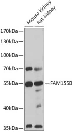 Invitrogen FAM155B Polyclonal Antibody 100 μL; Unconjugated:Antibodies,