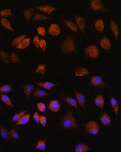 Invitrogen FAM3D Polyclonal Antibody 100 &mu;L; Unconjugated:Antibodies,